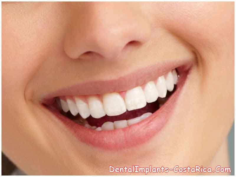 Extractions And Immediate Dentures Nashoba OK 74558